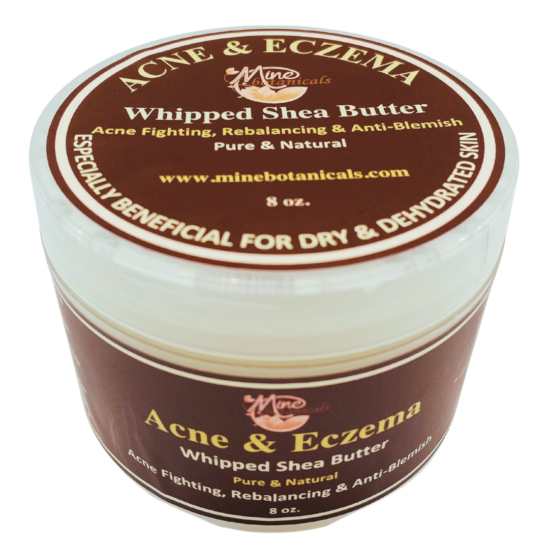 Acne & Eczema Whipped Shea Butter Mine Botanicals